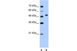 WB Suggested Anti-FLJ14213 Antibody Titration:  2. (FLJ14213 (N-Term) Antikörper)