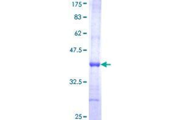 GMPPA Protein (AA 321-420) (GST tag)