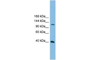 WB Suggested Anti-MAP3K14  Antibody Titration: 0. (MAP3K14 Antikörper  (N-Term))