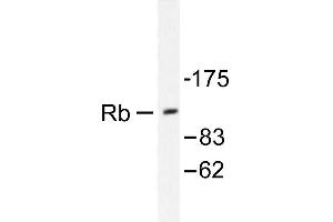 Image no. 1 for anti-Retinoblastoma 1 (RB1) antibody (ABIN271803) (Retinoblastoma 1 Antikörper)