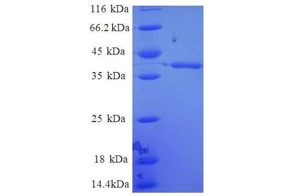 ERH Protein (AA 2-104, full length) (GST tag)