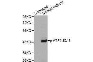 Western Blotting (WB) image for anti-Activating Transcription Factor 4 (Tax-Responsive Enhancer Element B67) (ATF4) (pSer245) antibody (ABIN1869995) (ATF4 Antikörper  (pSer245))