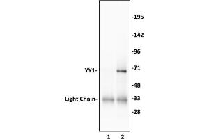 YY1 antibody (pAb) tested by Western blot. (YY1 Antikörper)