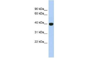 KIAA1191 antibody used at 1 ug/ml to detect target protein. (KIAA1191 Antikörper  (Middle Region))