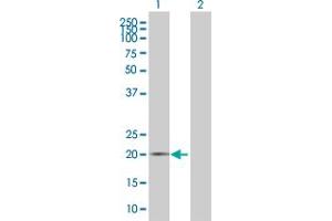 Lane 1: EEF1E1 transfected lysate ( 19. (EEF1E1 293T Cell Transient Overexpression Lysate(Denatured))