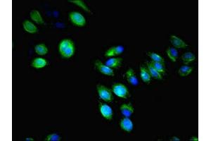 Immunofluorescent analysis of HepG2 cells using ABIN7158260 at dilution of 1:100 and Alexa Fluor 488-congugated AffiniPure Goat Anti-Rabbit IgG(H+L) (LILRA4 Antikörper  (AA 289-424))