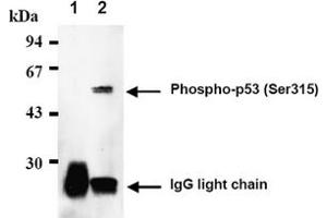 Western Blotting (WB) image for anti-Tumor Protein P53 (TP53) (pSer315) antibody (ABIN487474) (p53 Antikörper  (pSer315))