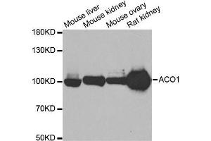 Western blot analysis of extracts of various cell lines, using ACO1 antibody. (Aconitase 1 Antikörper)