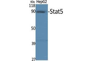 Western Blot (WB) analysis of specific cells using Stat5 Polyclonal Antibody. (STAT5A Antikörper)