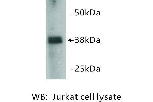 Image no. 1 for anti-Zinc Finger Protein 42 (ZFP42) antibody (ABIN1112835) (ZFP42 Antikörper)