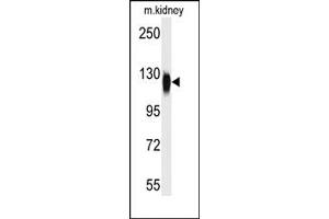 Image no. 1 for anti-Histone Deacetylase 6 (HDAC6) (C-Term) antibody (ABIN356649) (HDAC6 Antikörper  (C-Term))