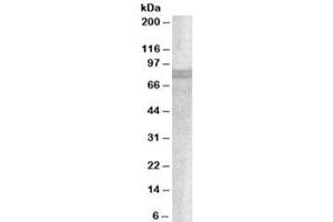 Western blot testing of A549 lysate with SNX18 antibody at 1ug/ml. (SNX18 Antikörper)
