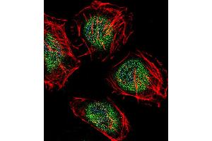 Fluorescent confocal image of Hela cell stained with CAF-1 Antibody (N-term). (CNOT8 Antikörper  (N-Term))