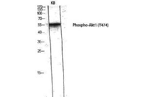 Western Blotting (WB) image for anti-V-Akt Murine Thymoma Viral Oncogene Homolog 1 (AKT1) (pTyr474) antibody (ABIN6283968) (AKT1 Antikörper  (pTyr474))