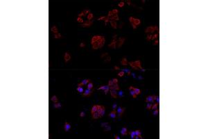 Immunofluorescence analysis of HeLa cells using CD40L antibody (ABIN6133614, ABIN6138190, ABIN6138191 and ABIN6216826) at dilution of 1:100. (CD40 Ligand Antikörper  (AA 79-129))
