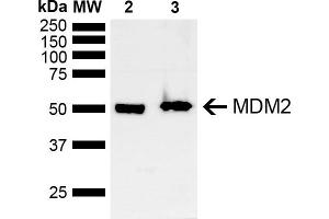 Western blot analysis of Mouse, Rat Brain showing detection of ~40 kDa MDM2 protein using Rabbit Anti-MDM2 Polyclonal Antibody (ABIN5667995). (MDM2 Antikörper  (AA 100-200) (Atto 488))