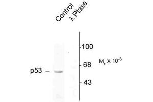 Image no. 2 for anti-Tumor Protein P53 (TP53) (pSer392) antibody (ABIN228202) (p53 Antikörper  (pSer392))