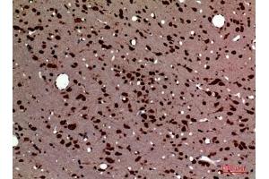 Immunohistochemical analysis of paraffin-embedded rat-brain, antibody was diluted at 1:100. (Pleiotrophin Antikörper  (Internal Region))