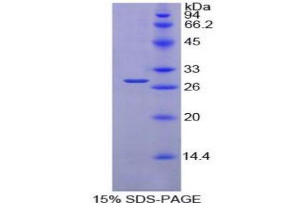 PDIA2 Protein