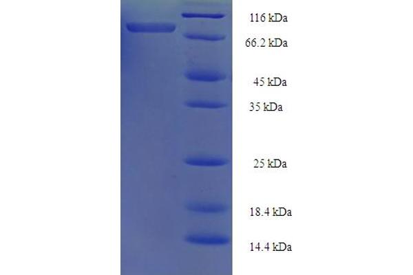 ATP5A1 Protein (AA 44-553) (His-SUMO Tag)