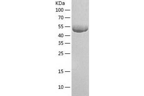 TAB1 Protein (AA 1-504) (His tag)