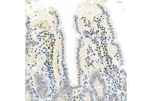 Immunohistochemistry analysis of paraffin-embedded mouse colon using,EEA1 (ABIN7073795) at dilution of 1: 2500 (EEA1 Antikörper)