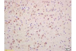 Formalin-fixed and paraffin embedded rat brain labeled with Rabbit Anti Phospho-Histone H3 (Ser10) Polyclonal Antibody, Unconjugated (ABIN742553) at 1:200 followed by conjugation to the secondary antibody and DAB staining (Histone 3 Antikörper  (pSer11))
