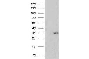 HEK293T cells were transfected with the pCMV6-ENTRY control (Left lane) or pCMV6-ENTRY RASSF5 (Right lane) cDNA for 48 hrs and lysed. (RASSF5 Antikörper)