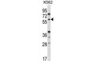 Western Blotting (WB) image for anti-Recombination Activating Gene 2 (RAG2) antibody (ABIN5978584) (RAG2 Antikörper)