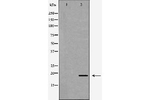 Western blot analysis of K562  using C19orf10 antibody. (C19orf10 Antikörper)