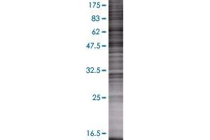 Western Blotting (WB) image for SFTPB 293T Cell Transient Overexpression Lysate(Denatured) (ABIN1333456)