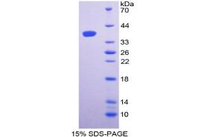 SDS-PAGE analysis of Rat Complement Component 3 Protein. (C3 Protein)