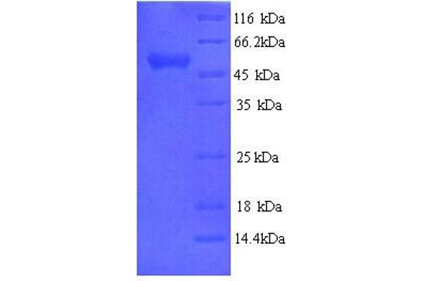 Arylsulfatase B Protein (ARSB) (AA 37-533) (His tag)