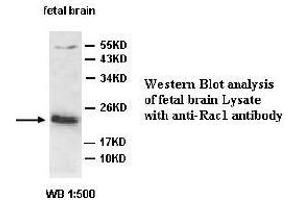 Image no. 2 for anti-RAC1 antibody (ABIN791257) (RAC1 Antikörper)