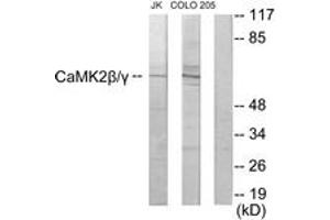 Western blot analysis of extracts from COLO205/Jurkat cells, using CaMK2 beta/gamma Antibody. (CaMK2 beta/gamma Antikörper  (AA 509-558))