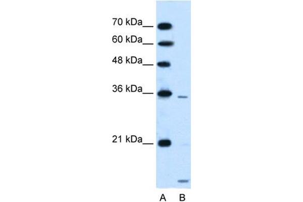 SLC25A39 Antikörper  (C-Term)