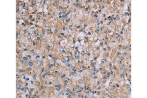 Immunohistochemistry (IHC) image for anti-Plexin A4 (PLXNA4) antibody (ABIN2435214) (Plexin A4 Antikörper)