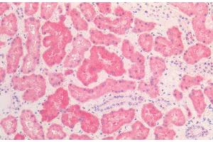 Immunohistochemistry analysis using Mouse Anti-HSP60 Monoclonal Antibody, Clone LK2 (ABIN2486568). (HSPD1 Antikörper  (PE))