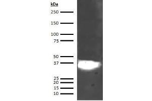 Western Blotting (WB) image for anti-Annexin A5 (ANXA5) (AA 1-320) antibody (ABIN5564834) (Annexin V Antikörper  (AA 1-320))