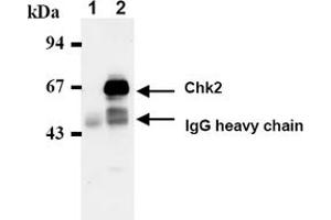 Western Blotting (WB) image for anti-Checkpoint Kinase 2 (CHEK2) antibody (ABIN487488) (CHEK2 Antikörper)