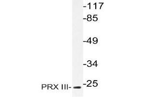 Western blot (WB) analysis of PRX III antibody in extracts from HeLa cells. (Peroxiredoxin 3 Antikörper)