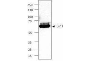 Western Blotting (WB) image for anti-Bridging Integrator 1 (BIN1) antibody (ABIN2664071) (BIN1 Antikörper)
