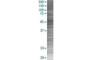 VIM transfected lysate. (VIM 293T Cell Transient Overexpression Lysate(Denatured))