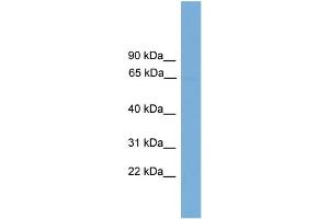 WB Suggested Anti-POLR3C Antibody Titration: 0. (POLR3C Antikörper  (Middle Region))