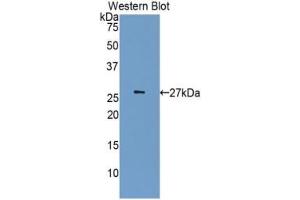 Detection of Recombinant CDK5, Human using Polyclonal Antibody to Cyclin Dependent Kinase 5 (CDK5) (CDK5 Antikörper  (AA 92-273))