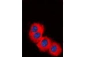 Immunofluorescent analysis of TSC2 staining in HepG2 cells. (Tuberin Antikörper)