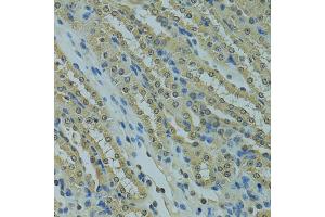 Immunohistochemistry of paraffin-embedded mouse kidney using UBE2I antibody. (UBE2I Antikörper)