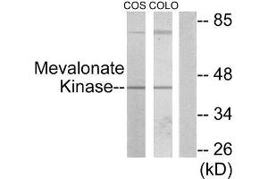 Western Blotting (WB) image for anti-Mevalonate Kinase (MVK) (Internal Region) antibody (ABIN1849535) (MVK Antikörper  (Internal Region))
