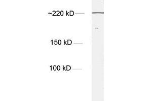 dilution: 1 : 1000, sample: NT2 cell lysate (Nestin Antikörper)