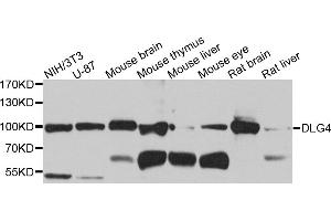 Western blot analysis of extracts of various cell lines, using DLG4 antibody. (DLG4 Antikörper)
